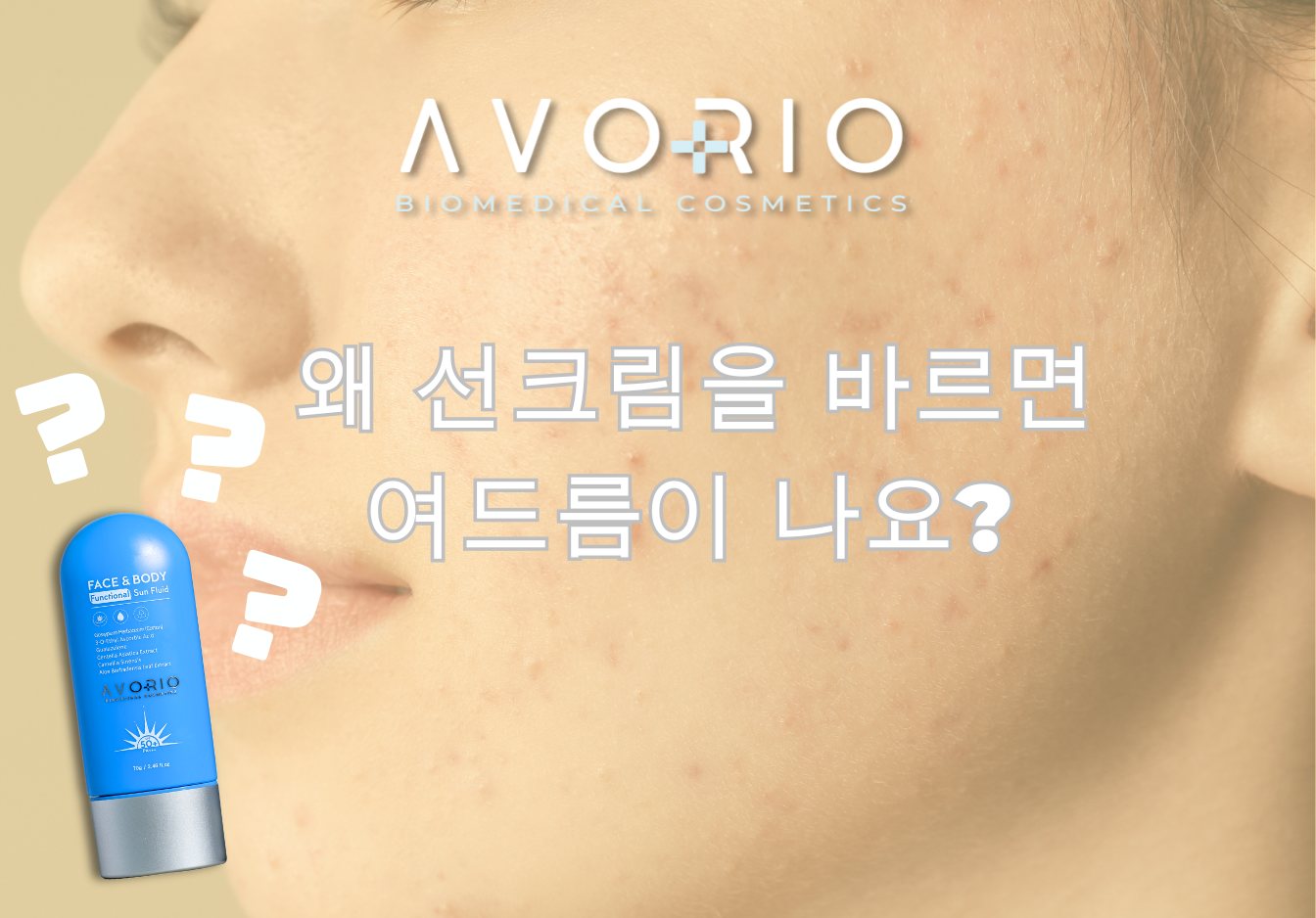 왜 선크림을 바르면 여드름이 나요?